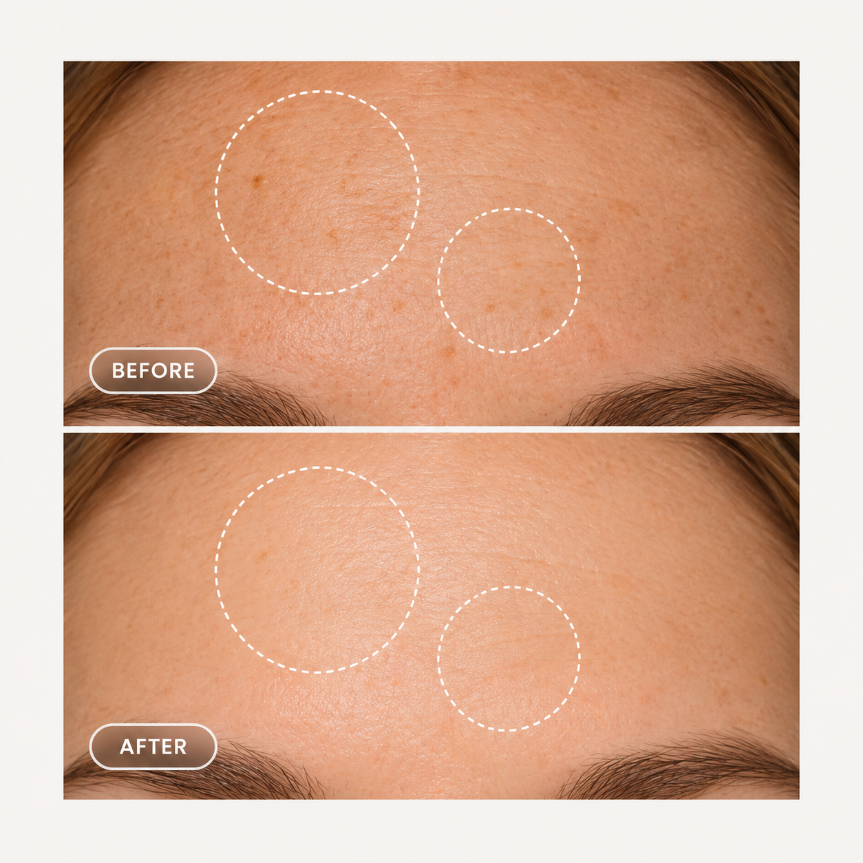 Retinol Alternative Serum, 30 ml
